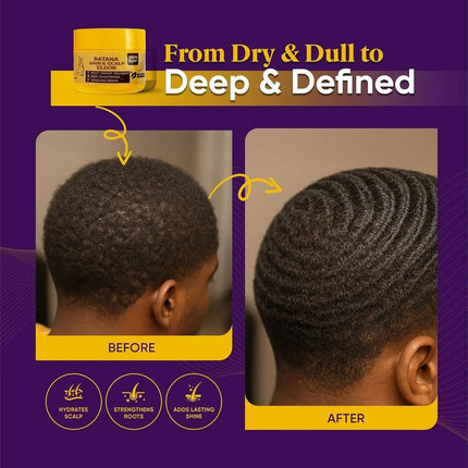 Scalp care routine with derma roller treatment
