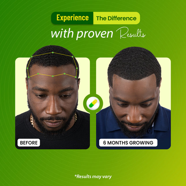 Rooted Strength Hair Growth Vitamins – Hair Vitamins for Black Women & Men