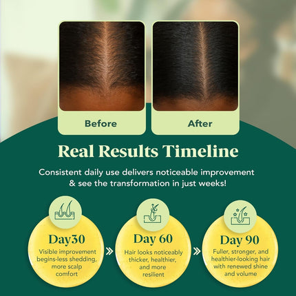 Ocean View Deep Juice Boost Hair Growth Oil & Scalp Serum | Batana Oil, Rosemary, Castor, Argan & Vitamin | 100ml